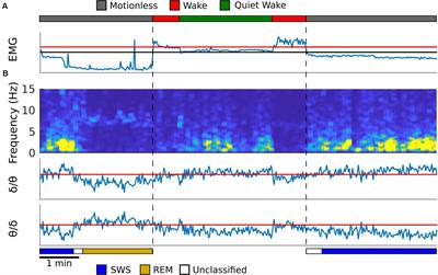 Assessment of Sleep, K-Complexes, and Sleep Spindles in a T21 Light-Dark Cycle